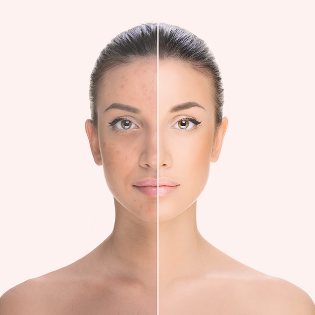 Laser-Skin-Rejuvenation-image (1) Laser-Skin-Rejuvenation-image (1)
